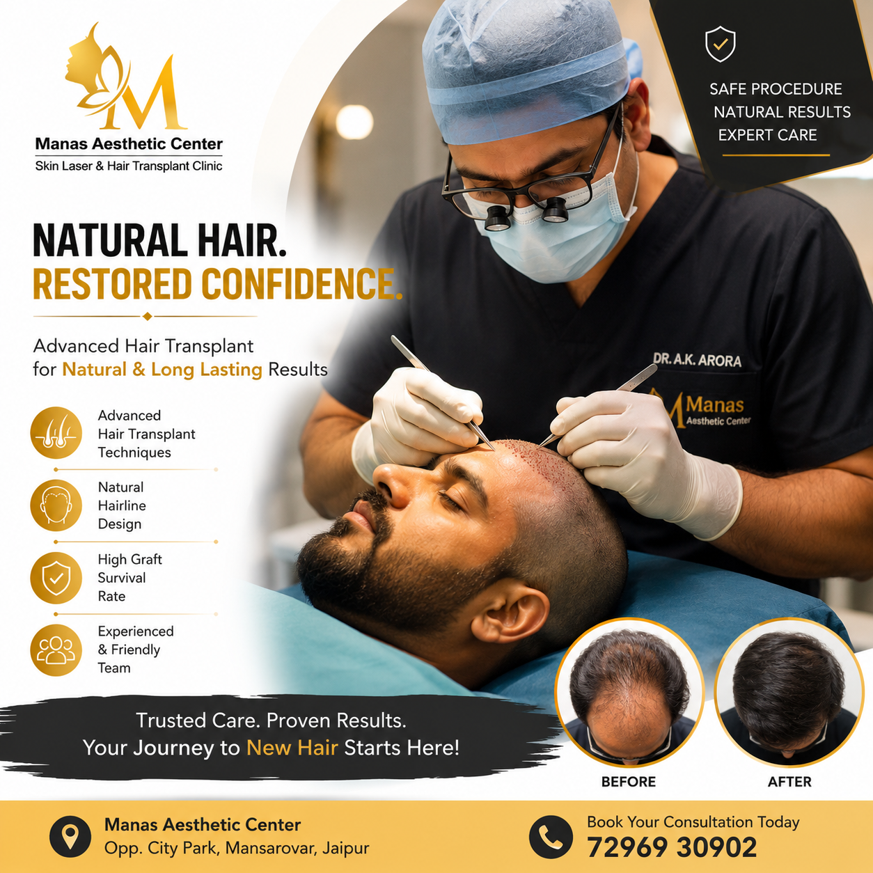 Manas Aesthetic Center hair transplant clinic in jaipur