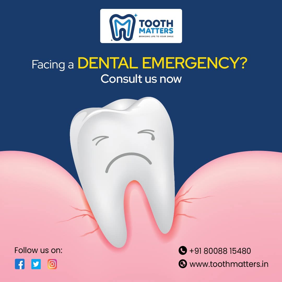 Tooth Matters – Advanced Teeth Whitening Services and Expert Root Canal Treatment